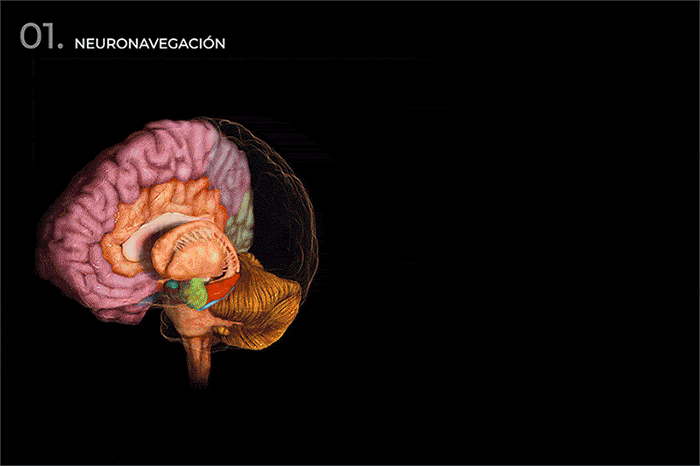 Doctor de Quintana brain surgery neuronavigation stereotaxic surgery brain microsurgery